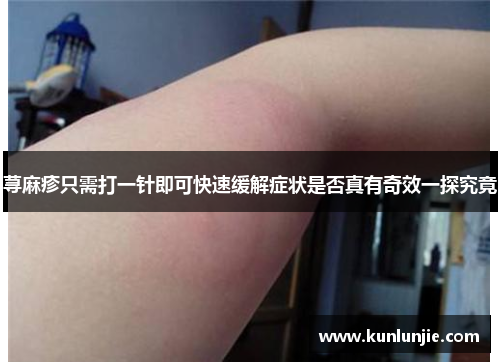 荨麻疹只需打一针即可快速缓解症状是否真有奇效一探究竟